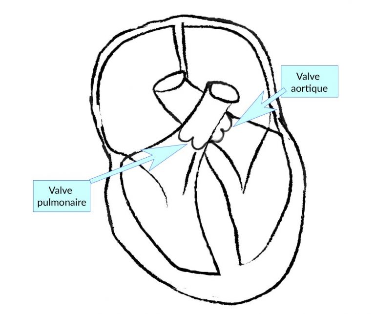 Maladies des valves cardiaques Centre Cœur et Santé